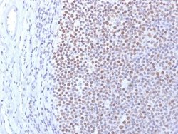 DNMT1 Antibody (DNMT1/2061) - Azide and BSA Free, Novus Biologicals 100 &mu;g | Buy Online | Novus Biologicals | Fisher Scientific